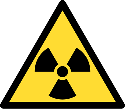 Radyoaktivite kansere neden olabilir